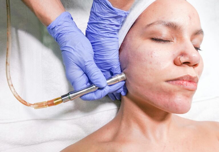 microdermabrasion skincare device