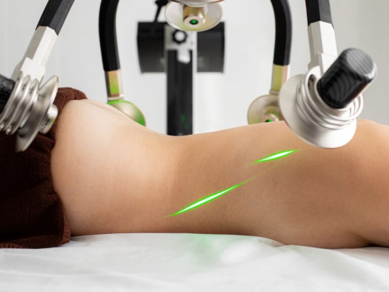 cryolipolysis device fat freezing machine