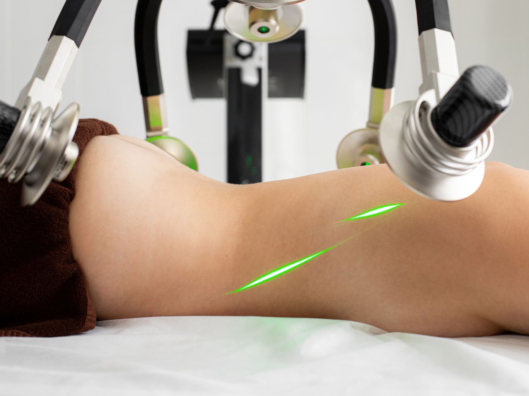 cryolipolysis device fat freezing machine