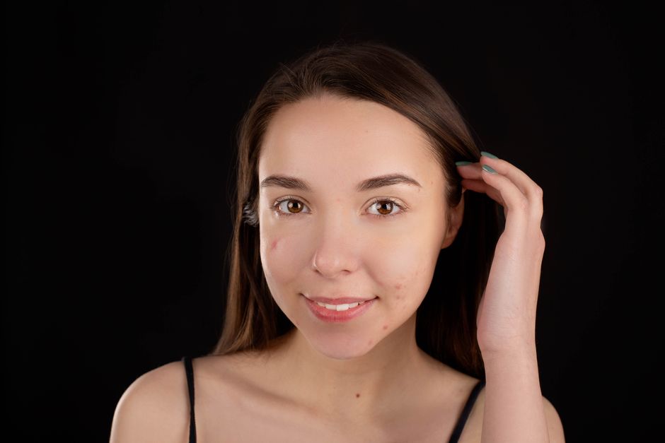 Omnilux CLEAR acne device