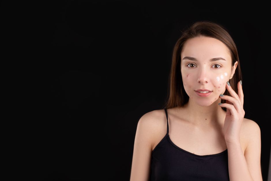 Neutrogena light therapy acne spot treatment